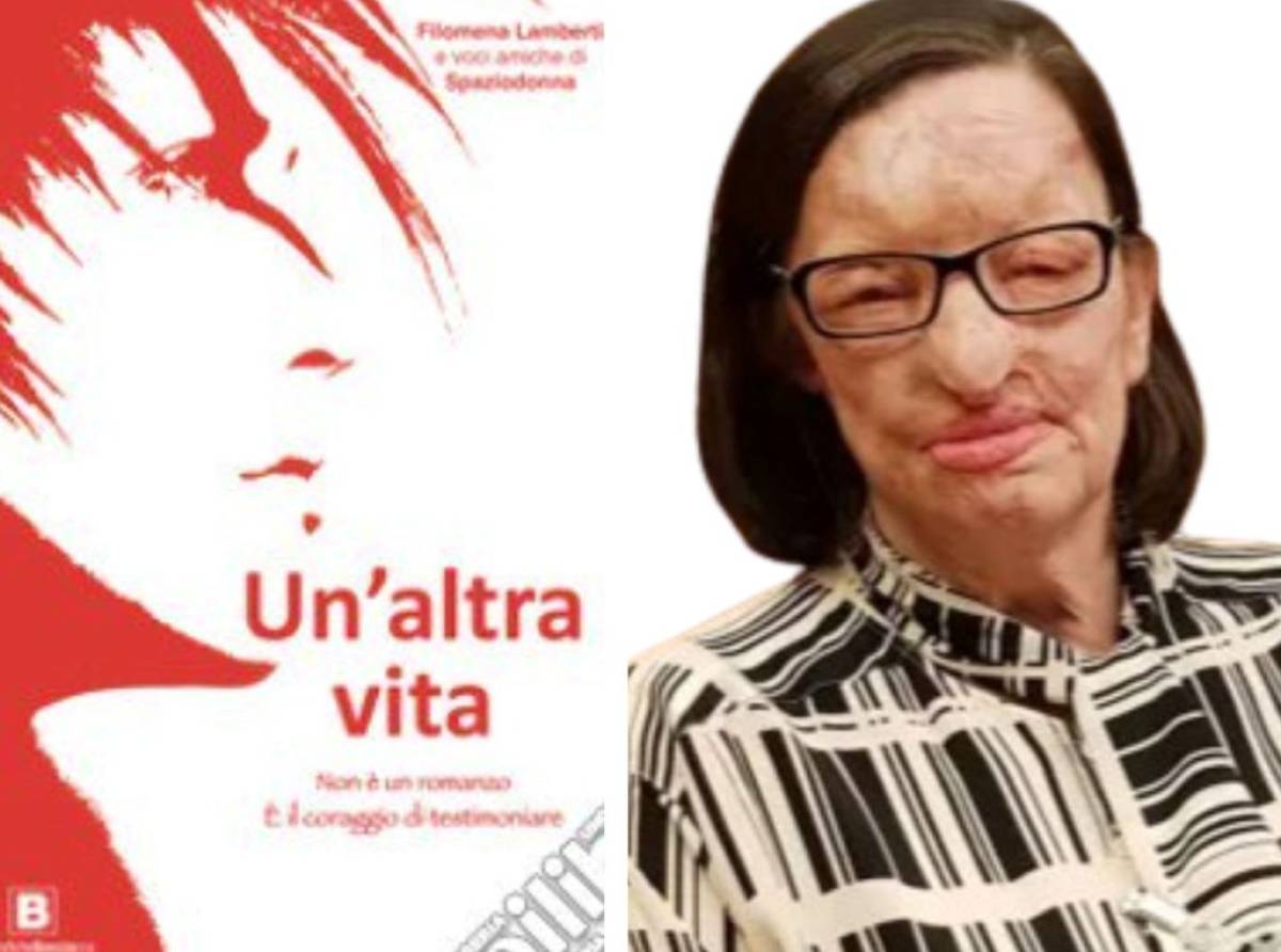 "Un'altra vita", il libro testimonianza di Filomena Lamberti, sfregiata dall'acido dall'ex marito. 