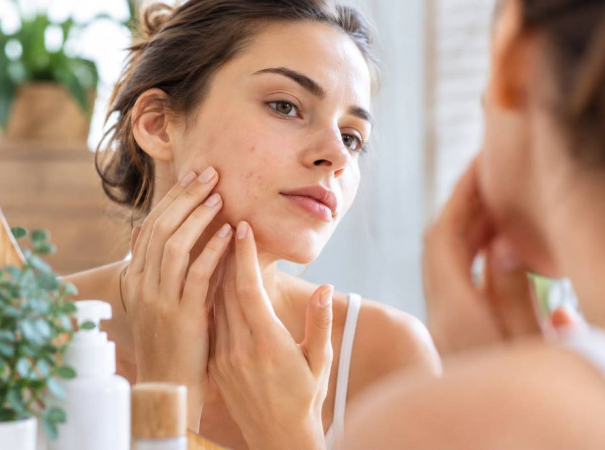 Acne in autunno e primavera: perché può peggiorare e come prendersi cura della pelle
